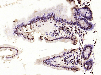 KLF4 Recombinant Rabbit Monoclonal Antibody