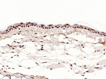 KLF4 Recombinant Rabbit Monoclonal Antibody