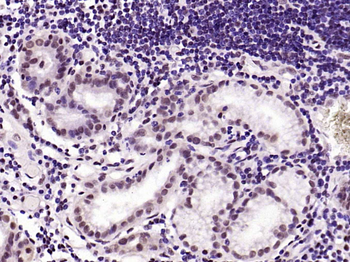 KLF4 Recombinant Rabbit Monoclonal Antibody