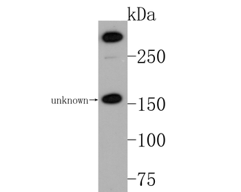 Phospho-ATM (Ser1981) Recombinant Rabbit Monoclonal Antibody