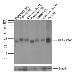 HLA-DQA1 Recombinant Rabbit Monoclonal Antibody