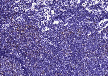 HLA-DQA1 Recombinant Rabbit Monoclonal Antibody