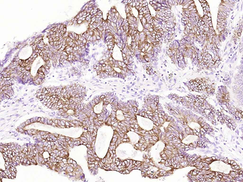 Cytokeratin 8 (Ready to use) Mouse Monoclonal Antibody