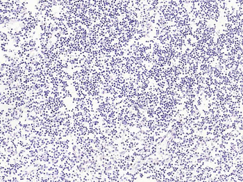 Cytokeratin 8 (Ready to use) Mouse Monoclonal Antibody