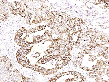 Cytokeratin 8 (Ready to use) Mouse Monoclonal Antibody