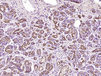 CK18 (ready to use) Mouse Monoclonal Antibody
