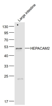 HEPACAM2 Rabbit Polyclonal Antibody