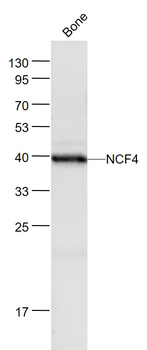 NCF4 Rabbit Polyclonal Antibody