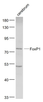 FoxP1 Rabbit Polyclonal Antibody