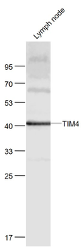 TIM4 Rabbit Polyclonal Antibody