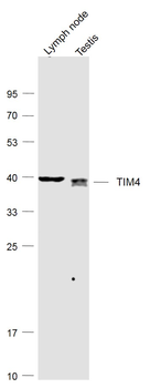 TIM4 Rabbit Polyclonal Antibody