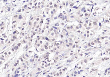 CDKN2A/p16-INK4a Rabbit Polyclonal Antibody