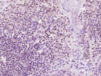 DNA PKcs Rabbit Polyclonal Antibody