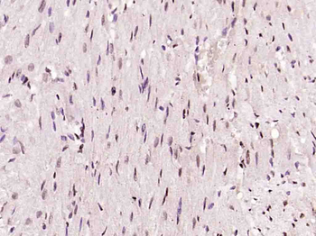 DNA PKcs Rabbit Polyclonal Antibody