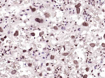 DNA PKcs Rabbit Polyclonal Antibody
