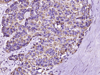 RASSF3 Rabbit Polyclonal Antibody