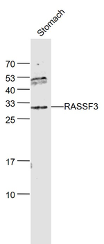 RASSF3 Rabbit Polyclonal Antibody