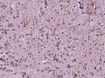 TSLC1 Rabbit Polyclonal Antibody