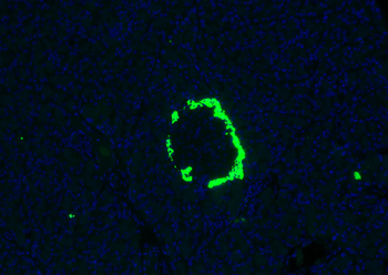 Glucagon Rabbit Polyclonal Antibody
