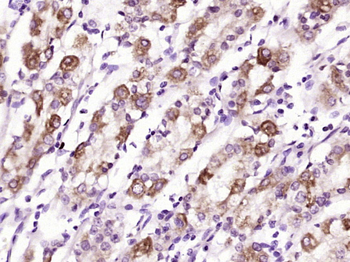Glucagon Receptor Rabbit Polyclonal Antibody