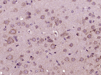 Glucagon Receptor Rabbit Polyclonal Antibody