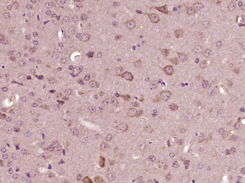 GNB2 Rabbit Polyclonal Antibody