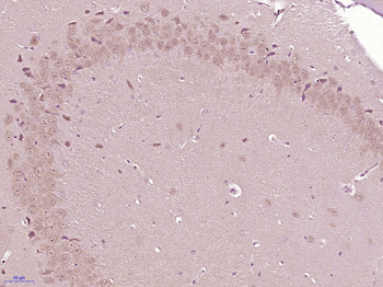 Phospho-Glycogen synthase 1 (Ser641) Rabbit Polyclonal Antibody