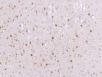 Zic2 Rabbit Polyclonal Antibody