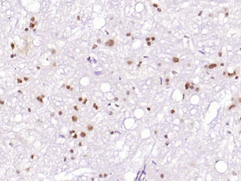 Zic2 Rabbit Polyclonal Antibody