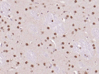 UBF1 Rabbit Polyclonal Antibody