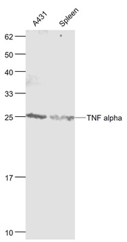 TNF Alpha antibody