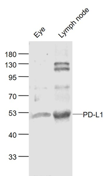PD-L1 Rabbit Polyclonal Antibody