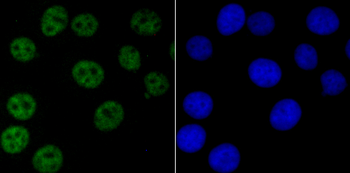 NRF1 Recombinant Rabbit Monoclonal Antibody