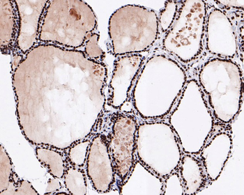 NRF1 Recombinant Rabbit Monoclonal Antibody