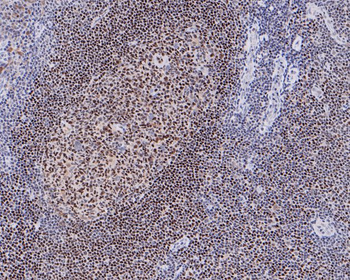 NRF1 Recombinant Rabbit Monoclonal Antibody