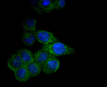 CPT2 Recombinant Rabbit Monoclonal Antibody
