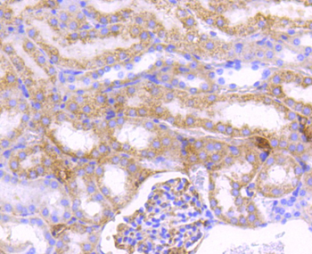 CPT2 Recombinant Rabbit Monoclonal Antibody