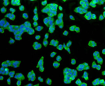 GLUT1 Recombinant Rabbit Monoclonal Antibody