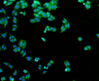 GLUT1 Recombinant Rabbit Monoclonal Antibody