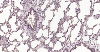 MMP12 Recombinant Rabbit Monoclonal Antibody