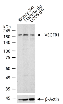 VEGFR1 Recombinant Rabbit Monoclonal Antibody