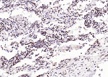TFRC Recombinant Rabbit Monoclonal Antibody