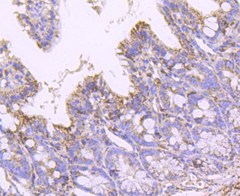 SOD2 Recombinant Rabbit Monoclonal Antibody