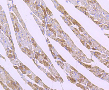 SOD2 Recombinant Rabbit Monoclonal Antibody