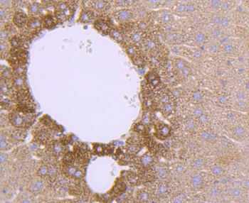 SOD2 Recombinant Rabbit Monoclonal Antibody