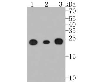 SOD2 Recombinant Rabbit Monoclonal Antibody
