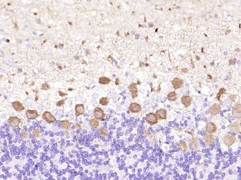 PKC delta Recombinant Rabbit Monoclonal Antibody