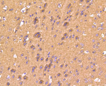 S100 beta Recombinant Rabbit Monoclonal Antibody