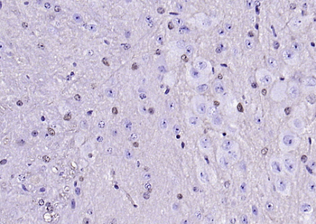 S100 beta Recombinant Rabbit Monoclonal Antibody