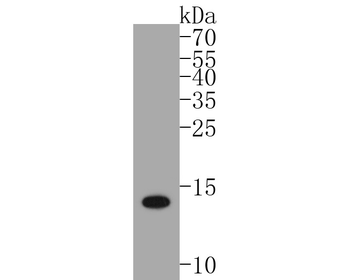 S100 beta Recombinant Rabbit Monoclonal Antibody